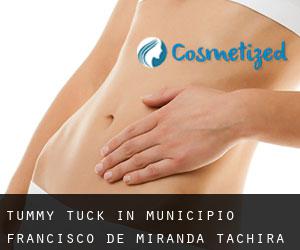 Tummy Tuck in Municipio Francisco de Miranda (Táchira)