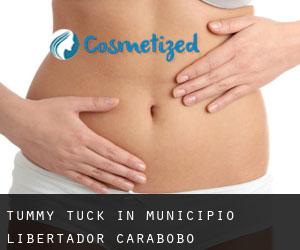 Tummy Tuck in Municipio Libertador (Carabobo)
