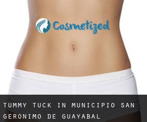 Tummy Tuck in Municipio San Gerónimo de Guayabal