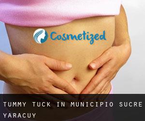 Tummy Tuck in Municipio Sucre (Yaracuy)