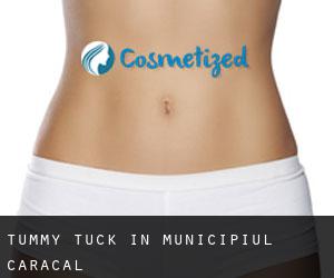 Tummy Tuck in Municipiul Caracal