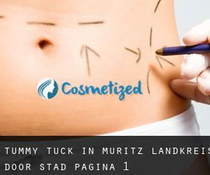 Tummy Tuck in Müritz Landkreis door stad - pagina 1
