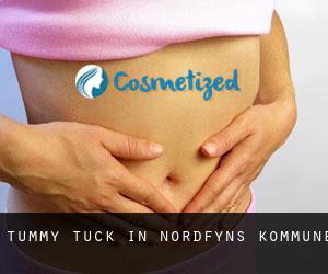 Tummy Tuck in Nordfyns Kommune