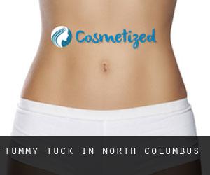 Tummy Tuck in North Columbus