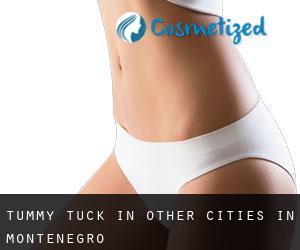 Tummy Tuck in Other Cities in Montenegro