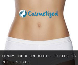 Tummy Tuck in Other Cities in Philippines