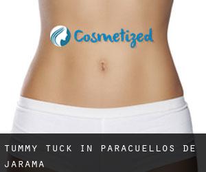Tummy Tuck in Paracuellos de Jarama