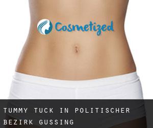 Tummy Tuck in Politischer Bezirk Güssing