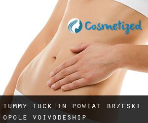 Tummy Tuck in Powiat brzeski (Opole Voivodeship)