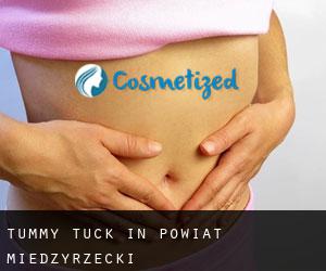 Tummy Tuck in Powiat międzyrzecki