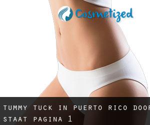 Tummy Tuck in Puerto Rico door Staat - pagina 1