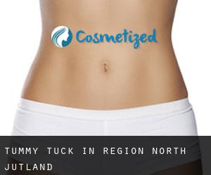 Tummy Tuck in Region North Jutland