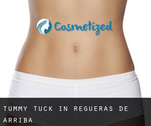 Tummy Tuck in Regueras de Arriba