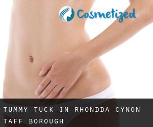 Tummy Tuck in Rhondda Cynon Taff (Borough)