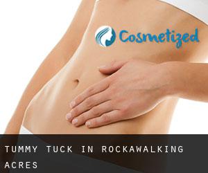Tummy Tuck in Rockawalking Acres