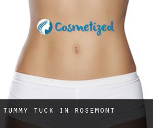 Tummy Tuck in Rosemont