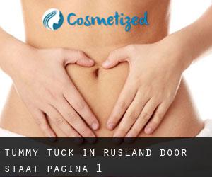 Tummy Tuck in Rusland door Staat - pagina 1