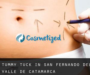 Tummy Tuck in San Fernando del Valle de Catamarca