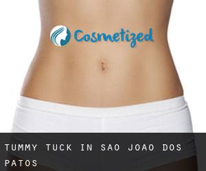 Tummy Tuck in São João dos Patos