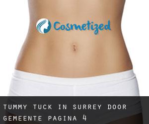 Tummy Tuck in Surrey door gemeente - pagina 4