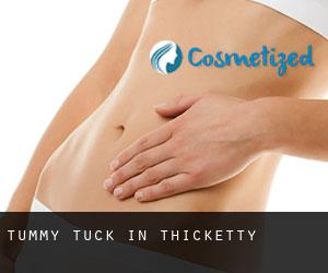 Tummy Tuck in Thicketty