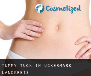 Tummy Tuck in Uckermark Landkreis