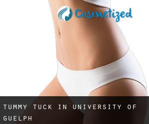 Tummy Tuck in University of Guelph