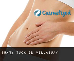 Tummy Tuck in Villaguay