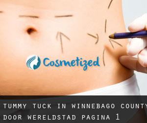Tummy Tuck in Winnebago County door wereldstad - pagina 1