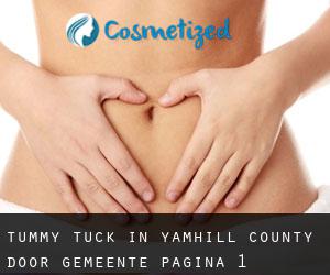 Tummy Tuck in Yamhill County door gemeente - pagina 1
