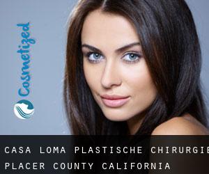 Casa Loma plastische chirurgie (Placer County, California)