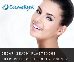 Cedar Beach plastische chirurgie (Chittenden County, Vermont)