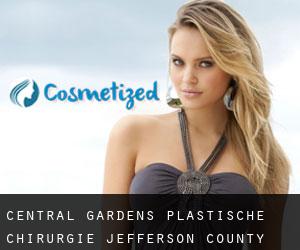 Central Gardens plastische chirurgie (Jefferson County, Texas)