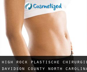High Rock plastische chirurgie (Davidson County, North Carolina)